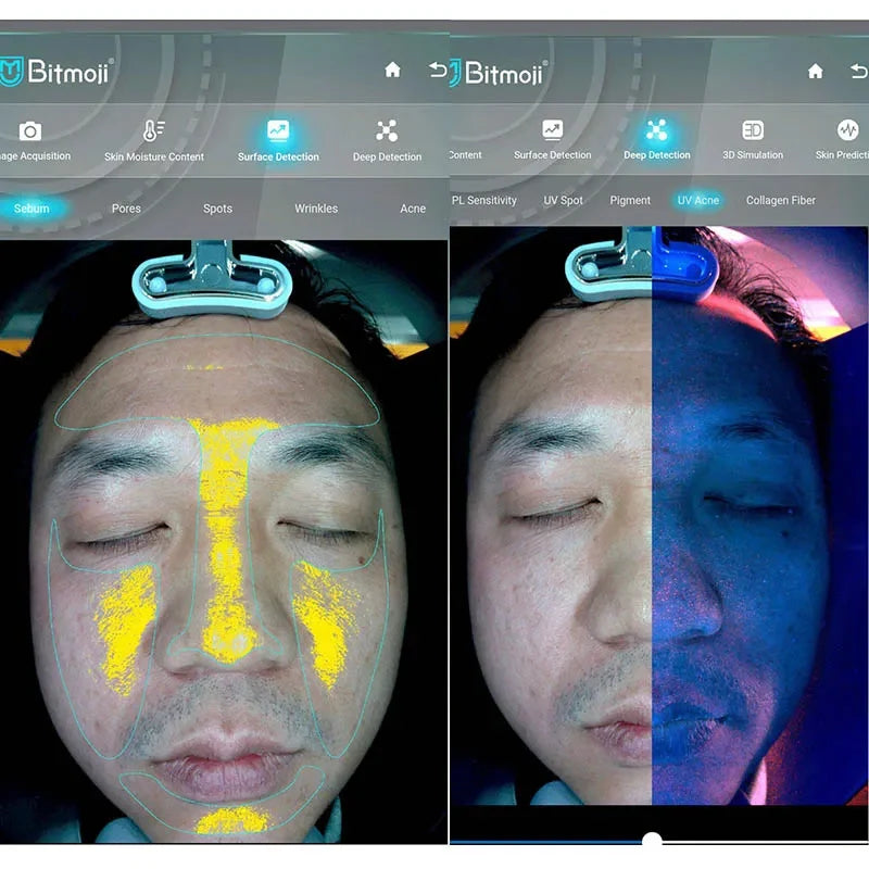 BOMP 3D Skin Scanner Facial Analyzer For Acne Pigmentation Wrinkle Analysis